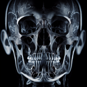 МРТ скронево-нижньощелепного суглоба