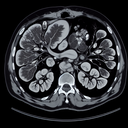 МРТ селезінки